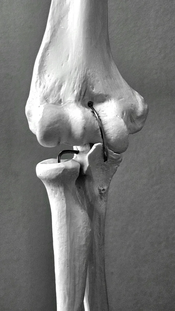 Ellbogen
